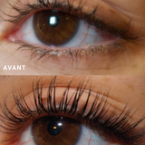 Sérum auralash